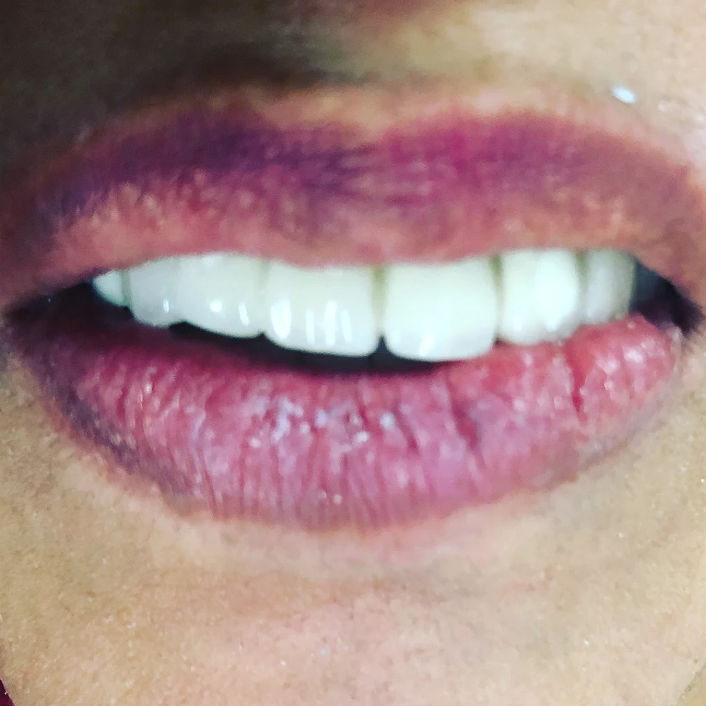 Close-up of a natural-looking smile with evenly shaped front teeth