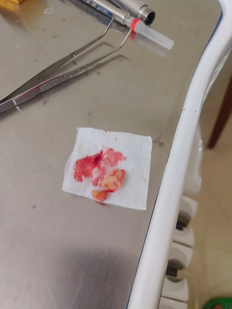 Gauze beside the dental chair after a dental procedure